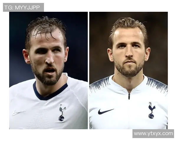 足球明星脱发问题揭秘这些球员的发量令人担忧 足球明星脱发问题揭秘这些球员的发量令人担忧